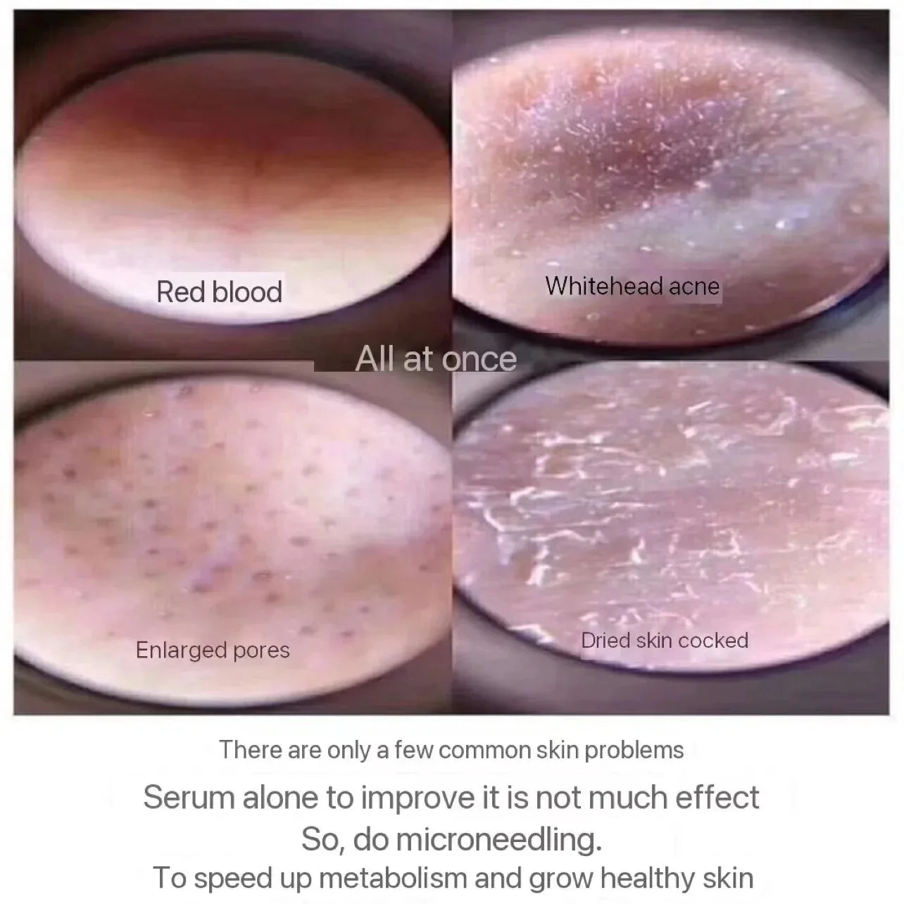 10pcs Sponge Microcrystal Freeze-dried Powder Collagen Regeneration Natural Biological
