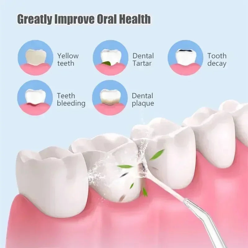 Oral Irrigator USB Teeth Cleaner